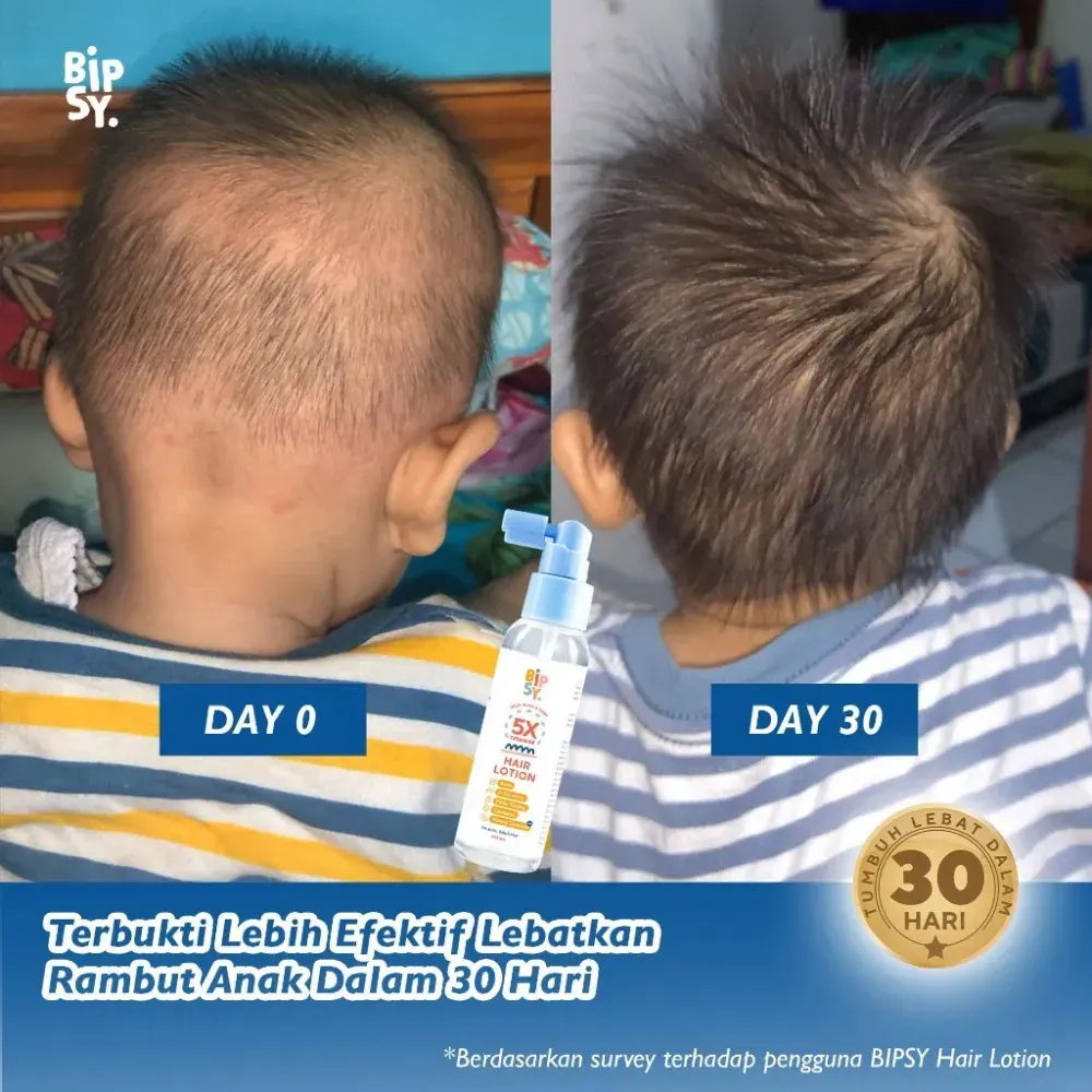 Perbandingan rambut anak hari ke-0 dan hari ke-30